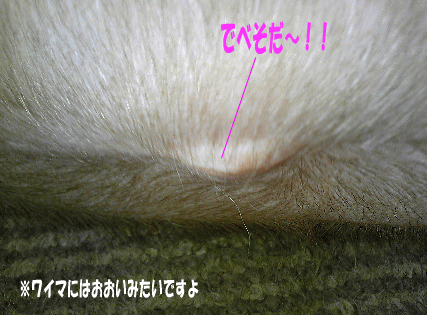デベソ